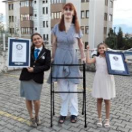 土耳其一女子创造新世界纪录 身高2.15米行走需要支架